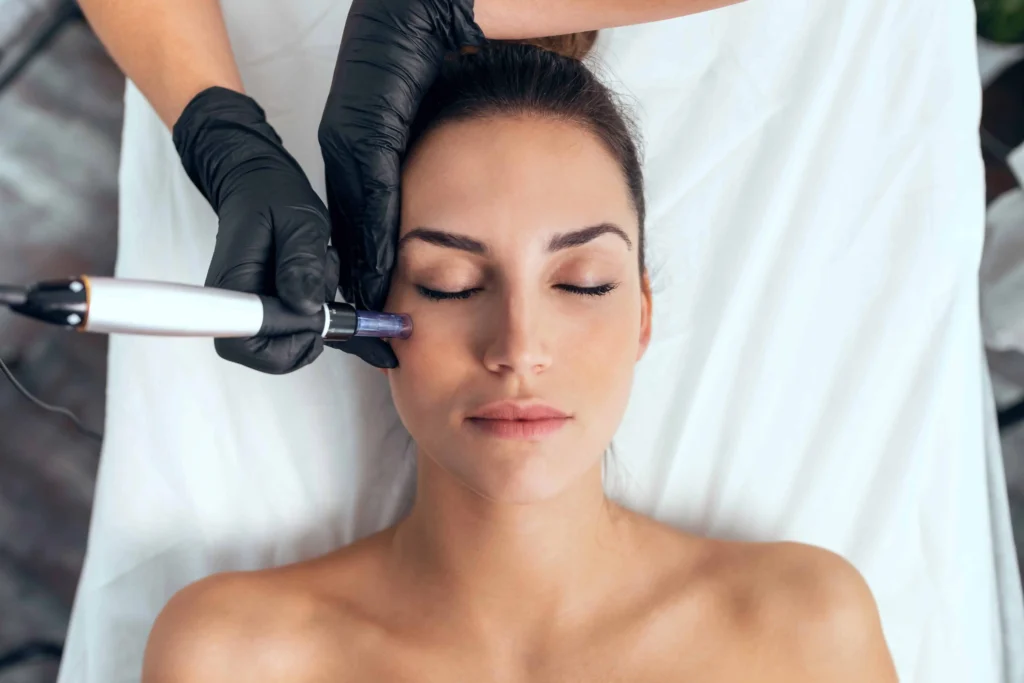 Microneedling Treatment in Hershey, PA, at Spruce Medical Aesthetics