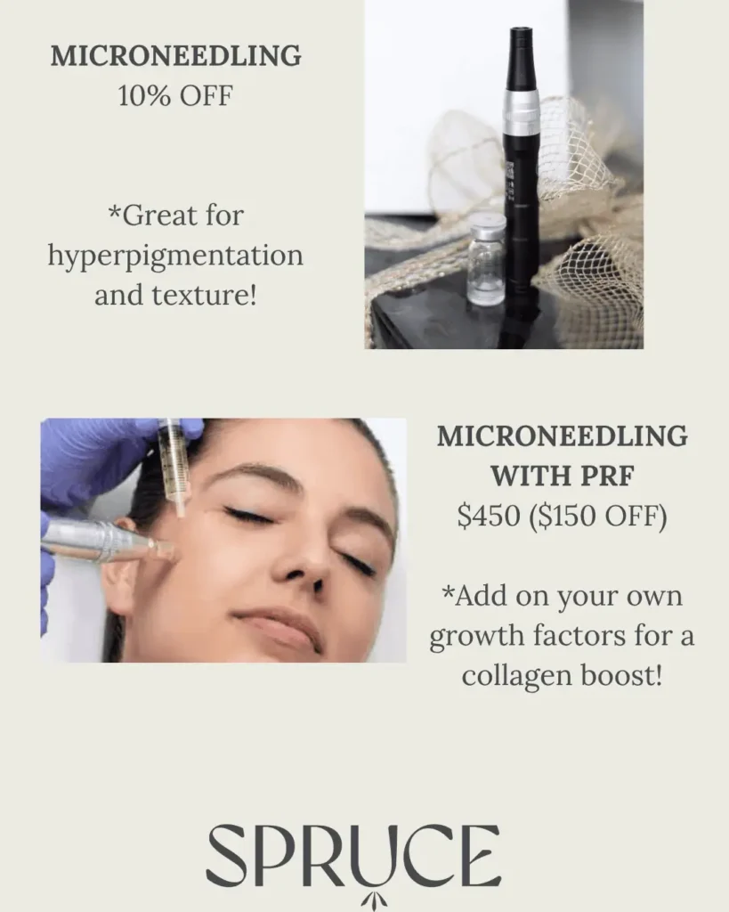 Offers on Microneedling and Microneedling With PRF | Spruce Medical Aesthetics