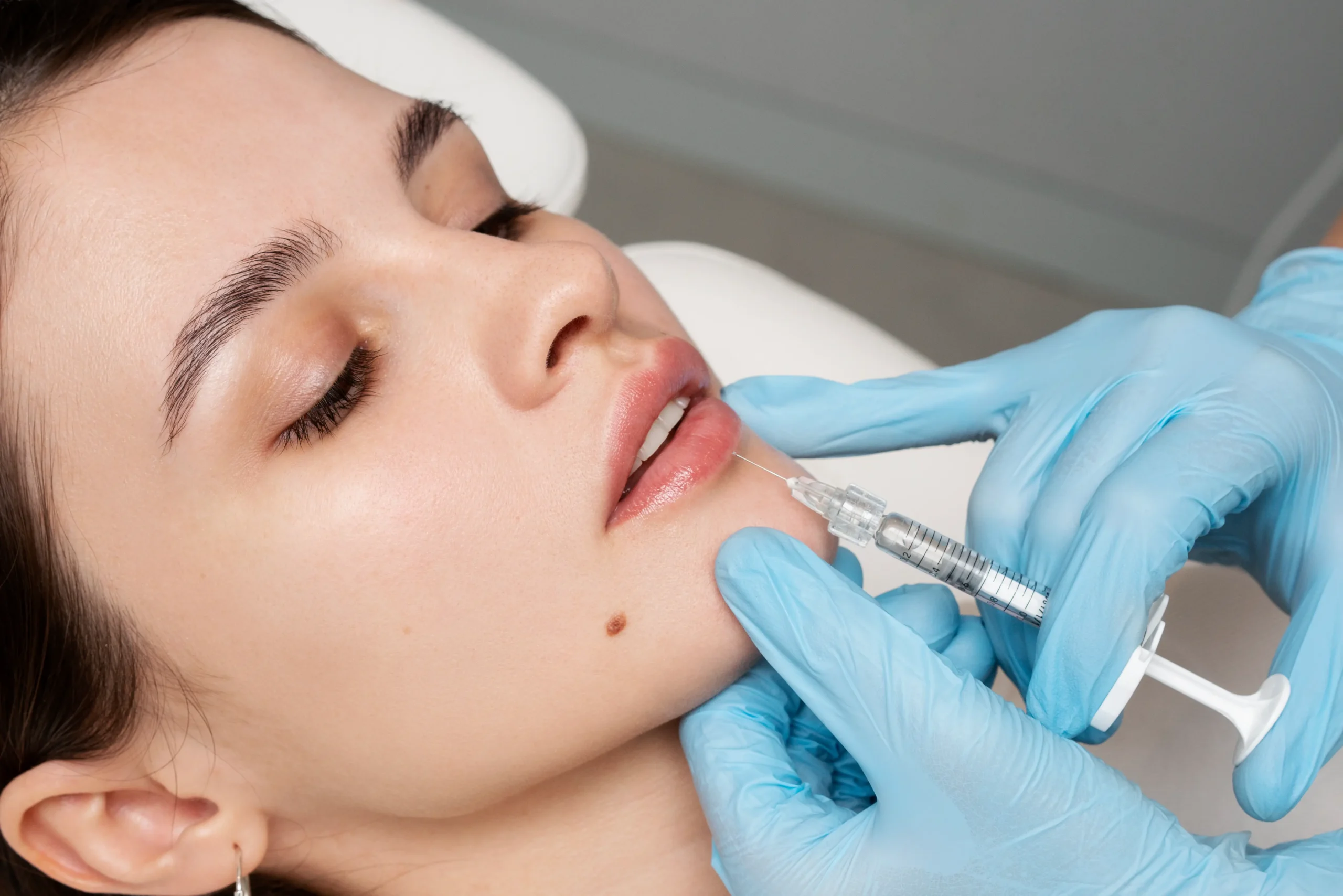 Gloved hands injecting filler into woman’s lower lip